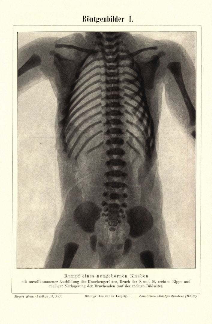 Röntgenbilder. Buchillustration (Stich) von 1898